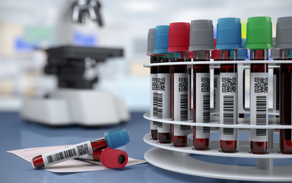 Blood tubes in the laboratory centrifuge