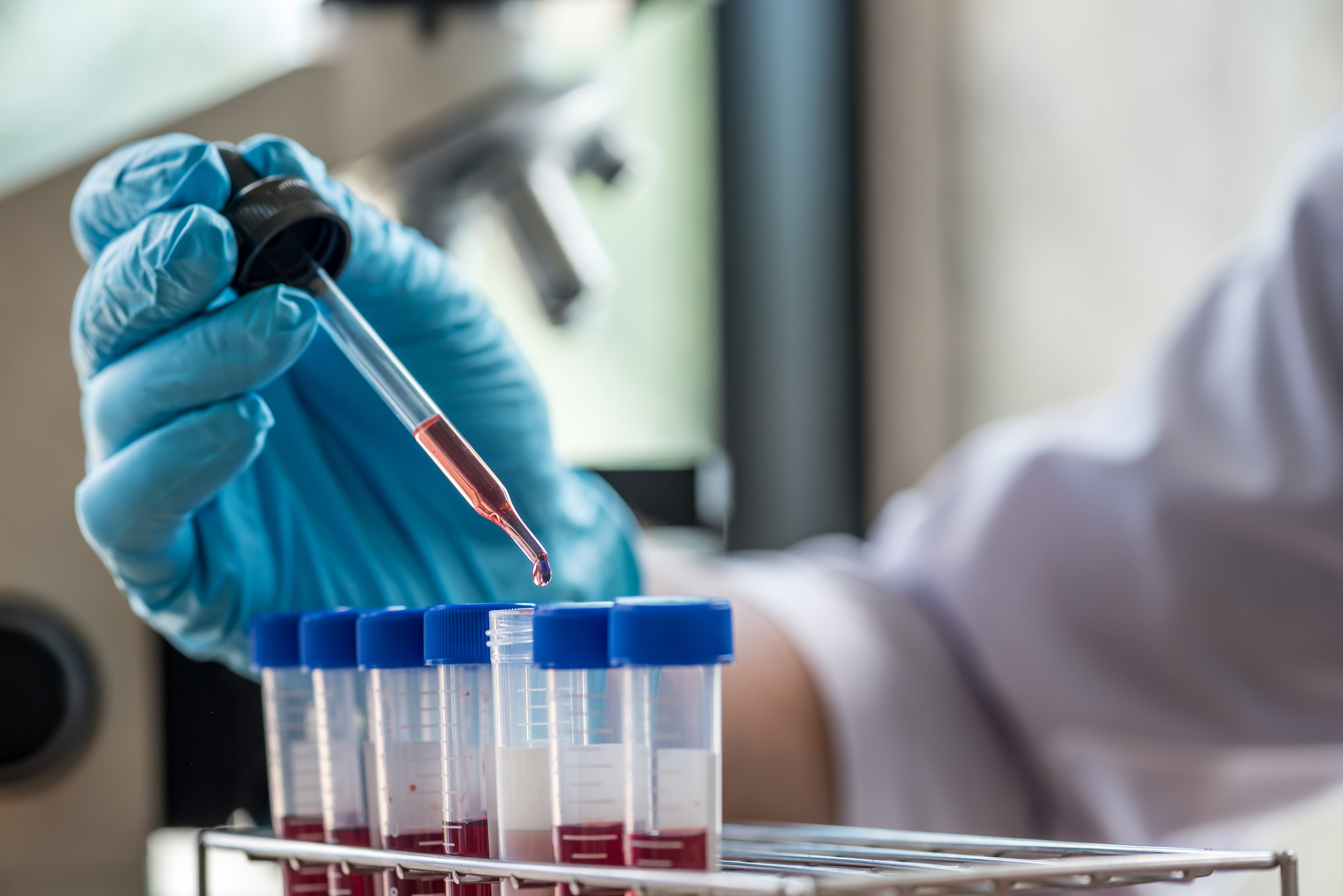 scientist or doctor dropping a blood into blood test tube in rack , research concept